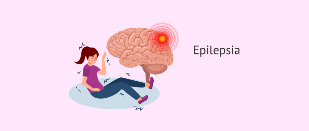 Sintomas de Epilepsia